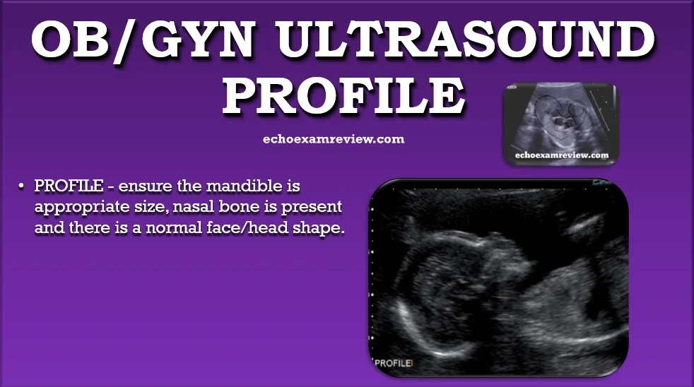 Ob Gyn Ultrasound Pictures