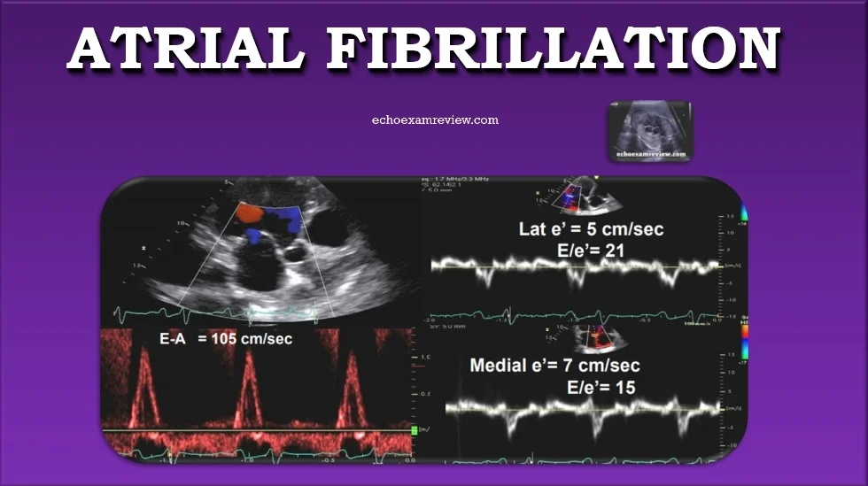 ASE Guidelines for assessing Diastolic Function during Atrial Fibrillation