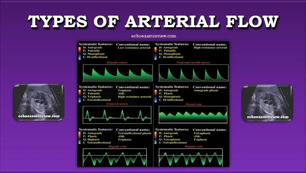 Arterial Waveforms