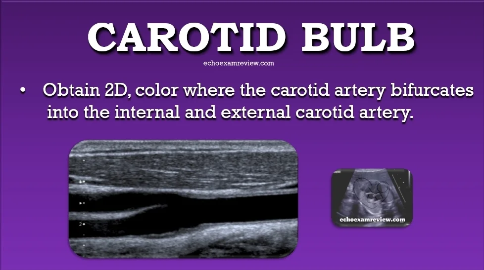 Carotid Artery Bulb