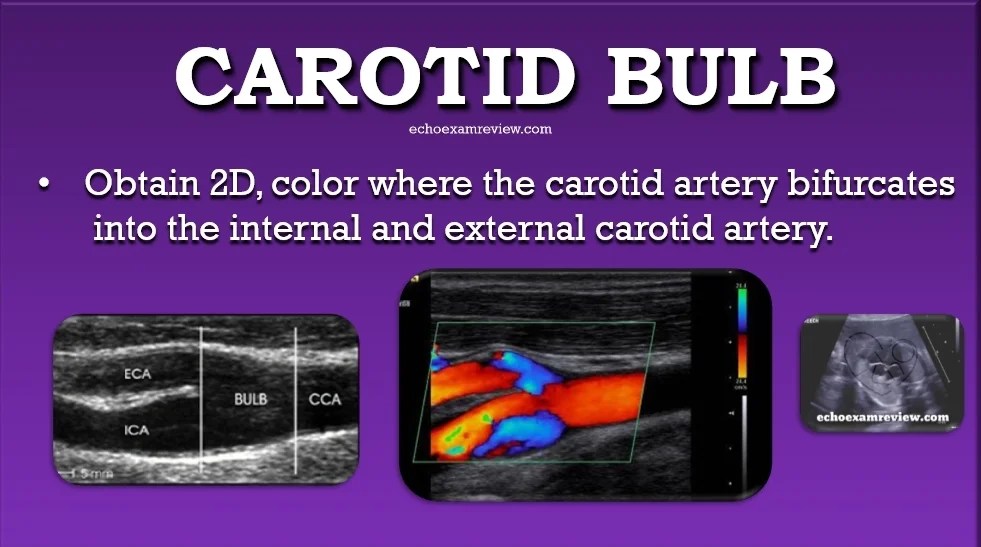 Carotid Artery Bulb