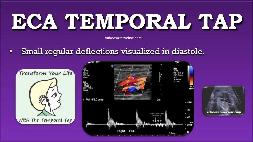 Temporal Tap