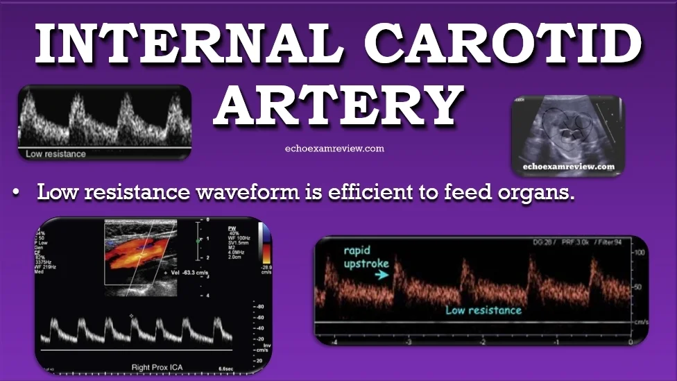 Internal Carotid Artery