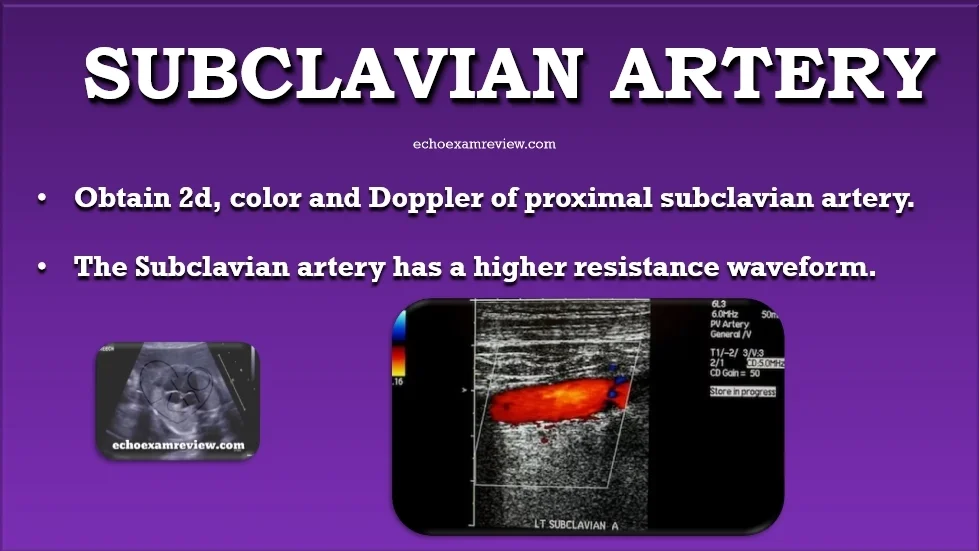 Subclavian Artery