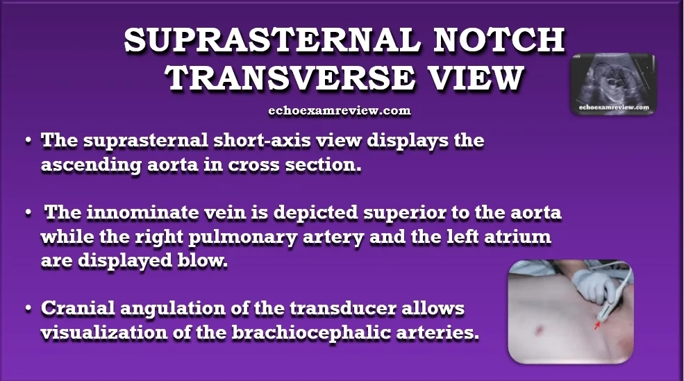 Suprasternal Transverse Aortic Arch View