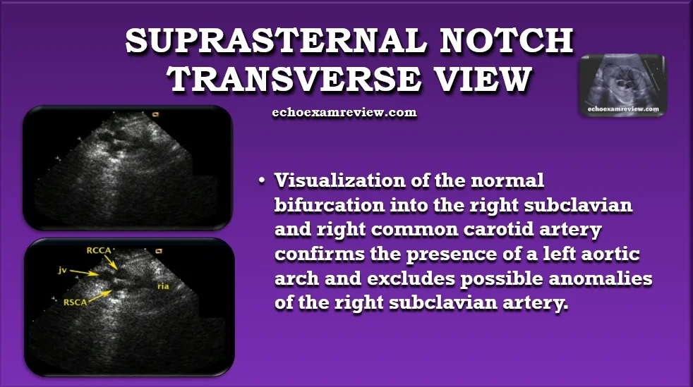 Suprasternal Transverse Aortic Arch View