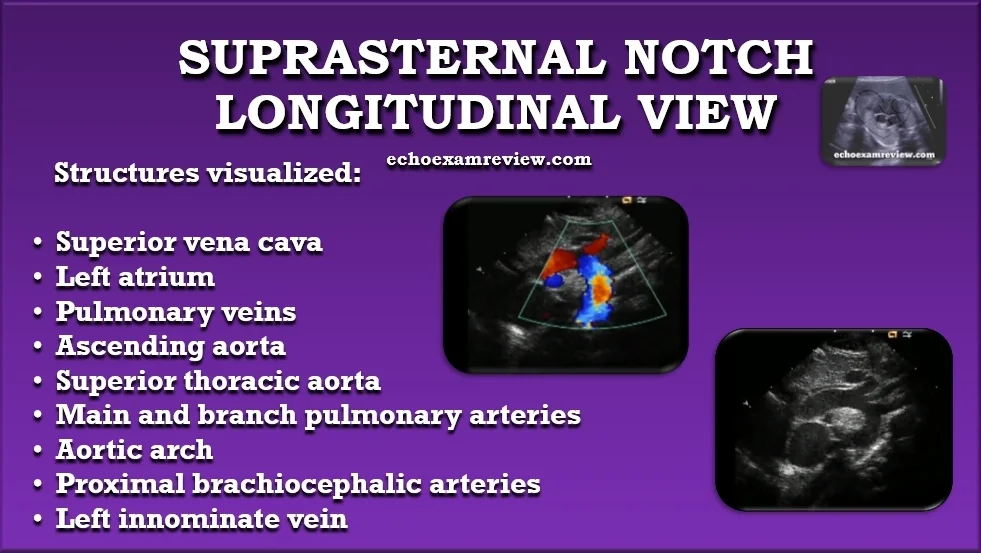 Suprasternal Longitudinal Aortic Arch View