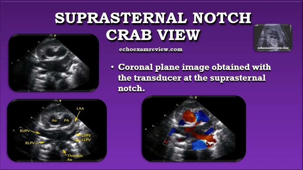 Crab View