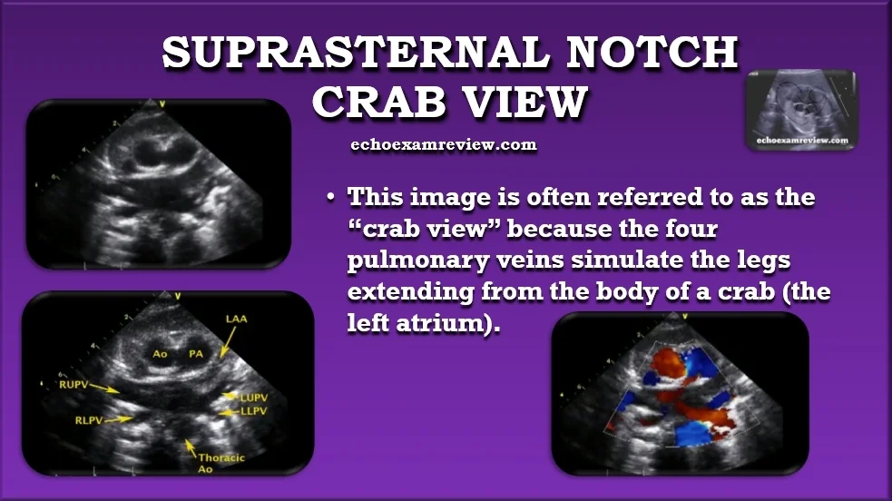 Crab View