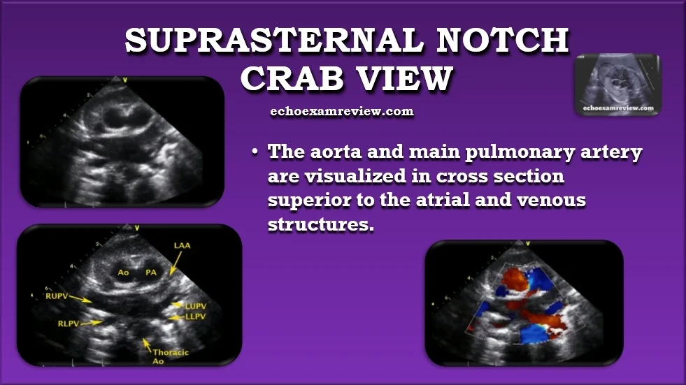 Crab View