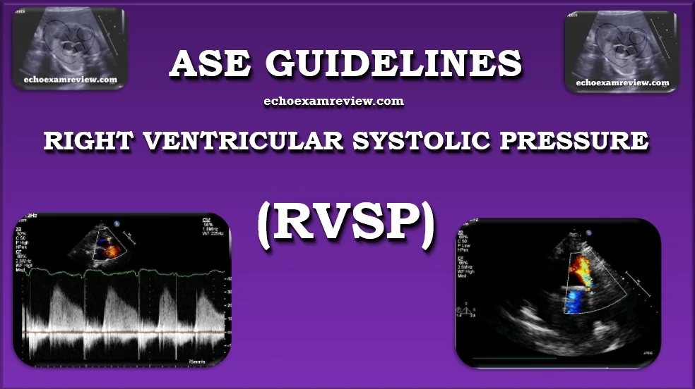 RVSP