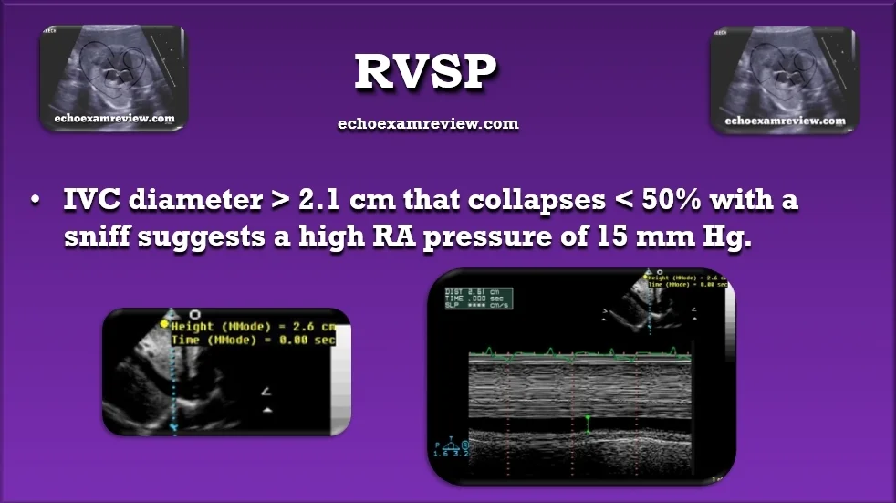 RA Pressure