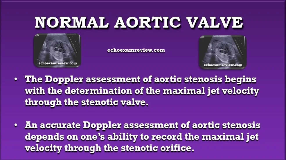 Normal Aortic Valve