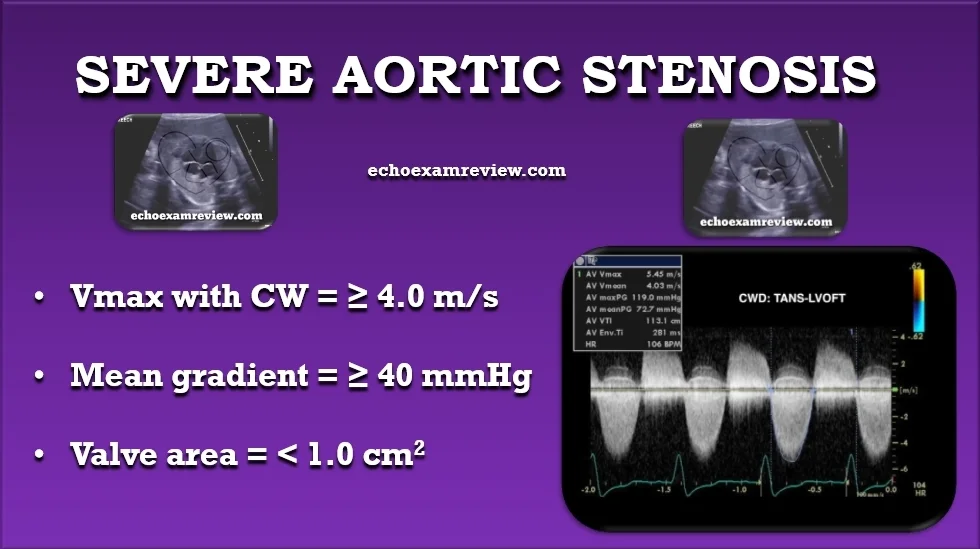Severe Aortic Stenosis