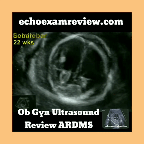 Ob Gyn Ultrasound Patau Syndrome Holoprosencephaly