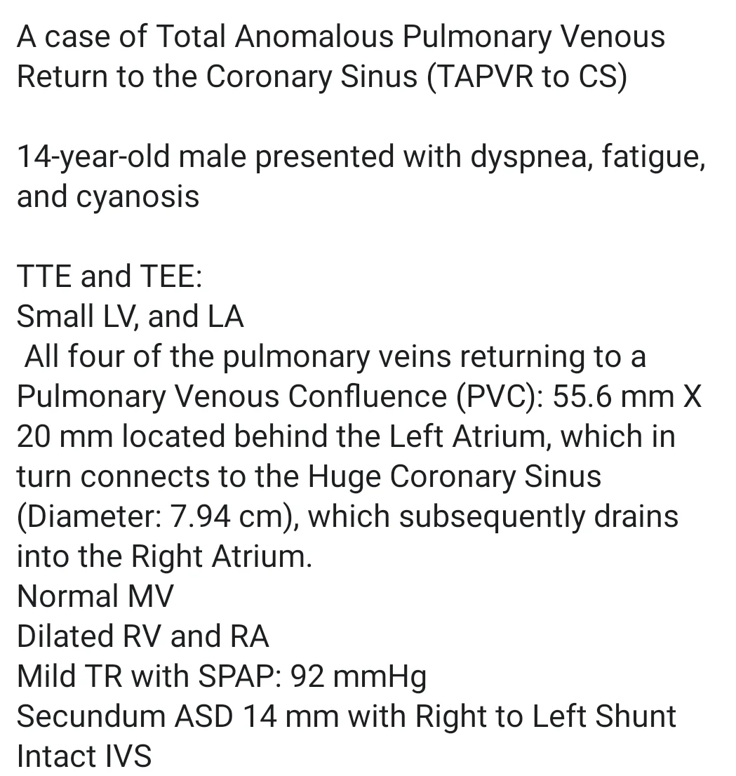 Total Anomalous Pulmonary Venous Return Cardiac Type