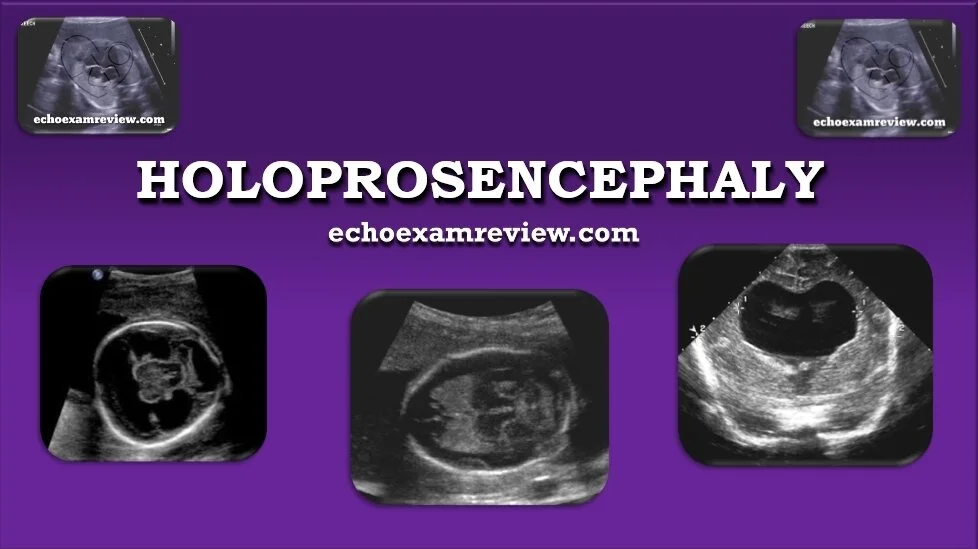 Holoprosencephaly