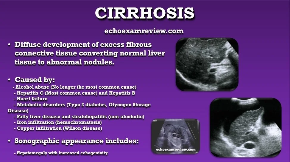 Ultrasound Board Review Ultrasound Board Review