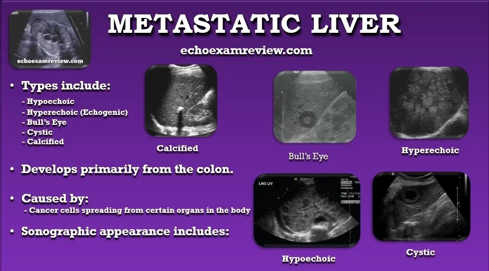 Metastatic Disease