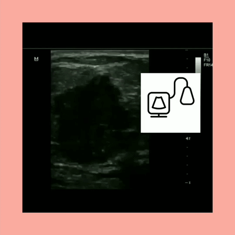 Breast Sonography Workbook