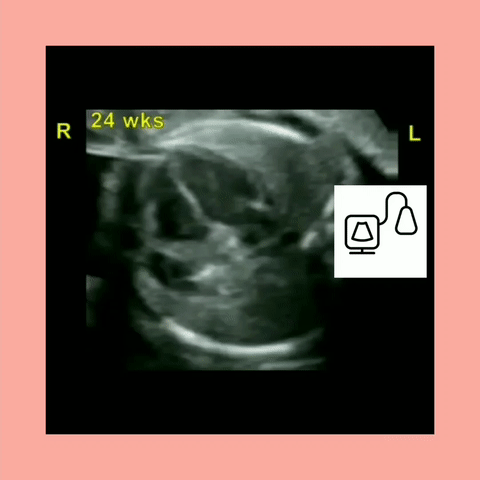 Fetal Echocardiography Workbook