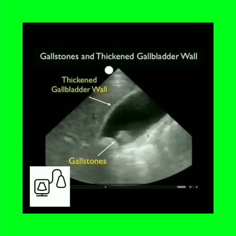 Abdominal Sonography Workbook.gif