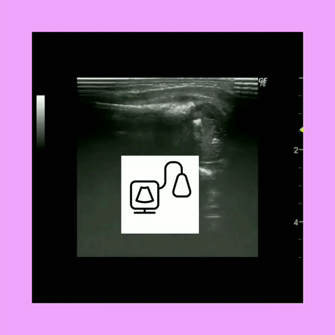 Pediatric Sonography Mock Exams