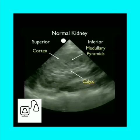Abdominal Sonography Registry Mock Exams