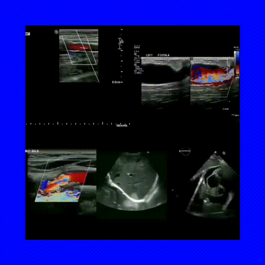 InShot_20200329_115523954  HQ0.GIF