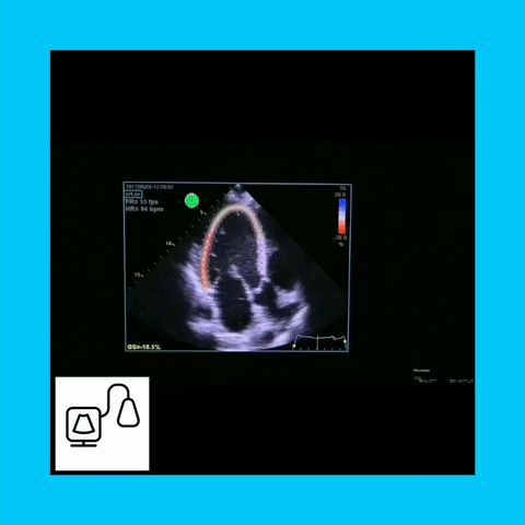 Advanced Cardiac Sonography Mock Exams