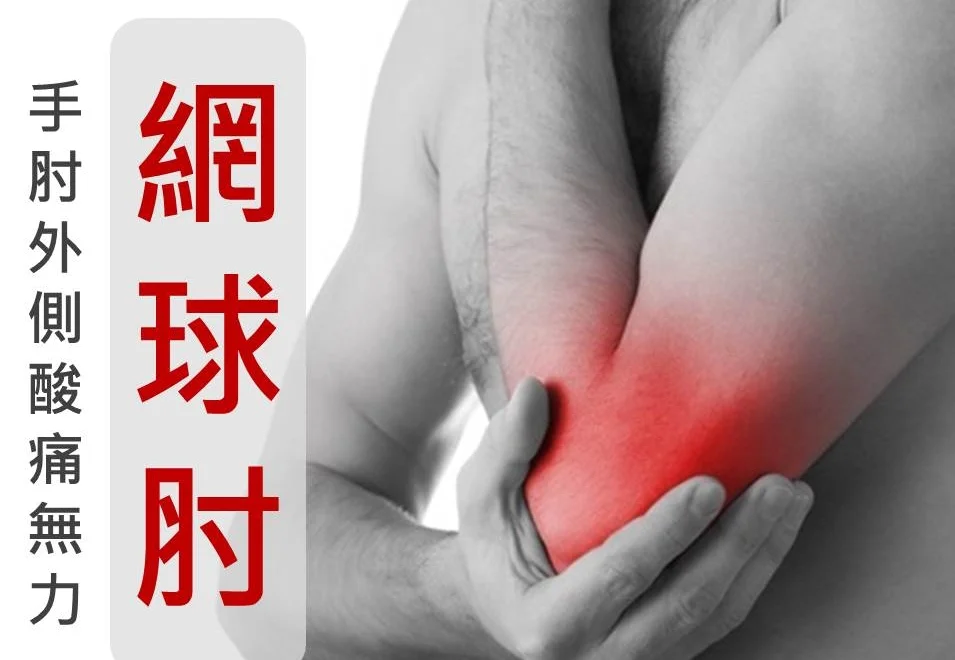 關節保護-手肘