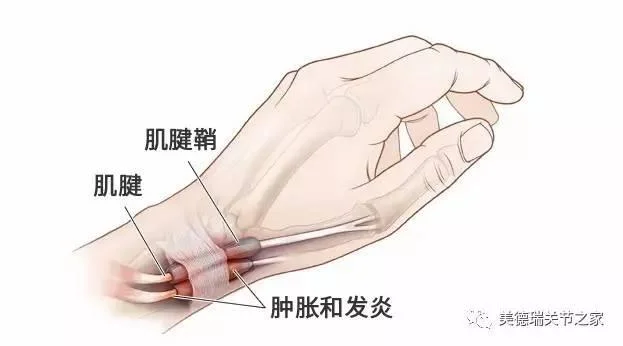 下載.jpg