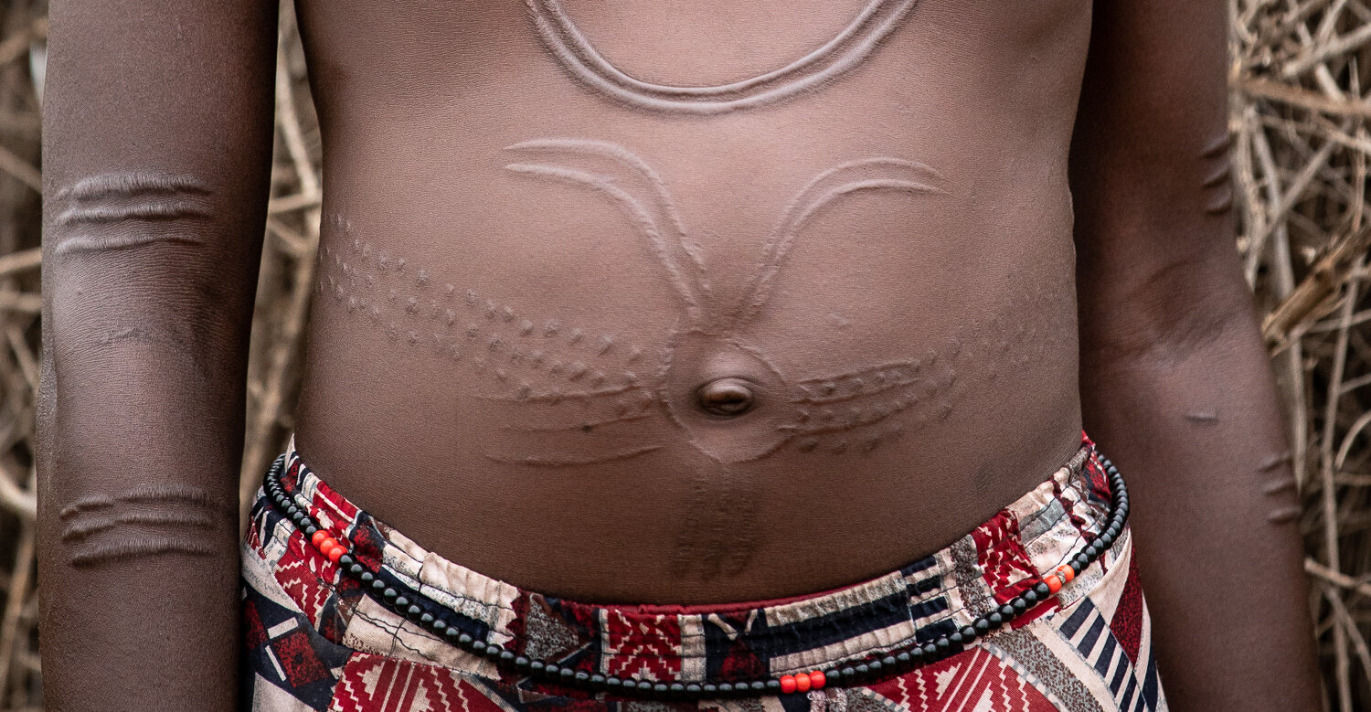  Body scaring is popular within the Omo Valley tribes. This photo is of a woman from the  Nyangatom tribe.  