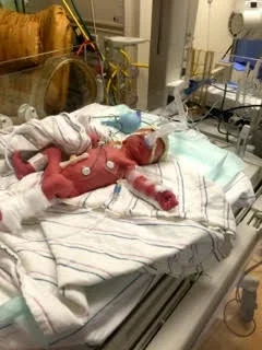 Izzy - Day 1