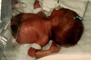 Madeline - Her dad’s wedding ring is on her tiny left arm!