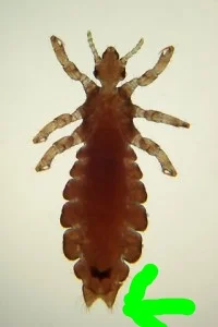 female-louse-200x300.jpg