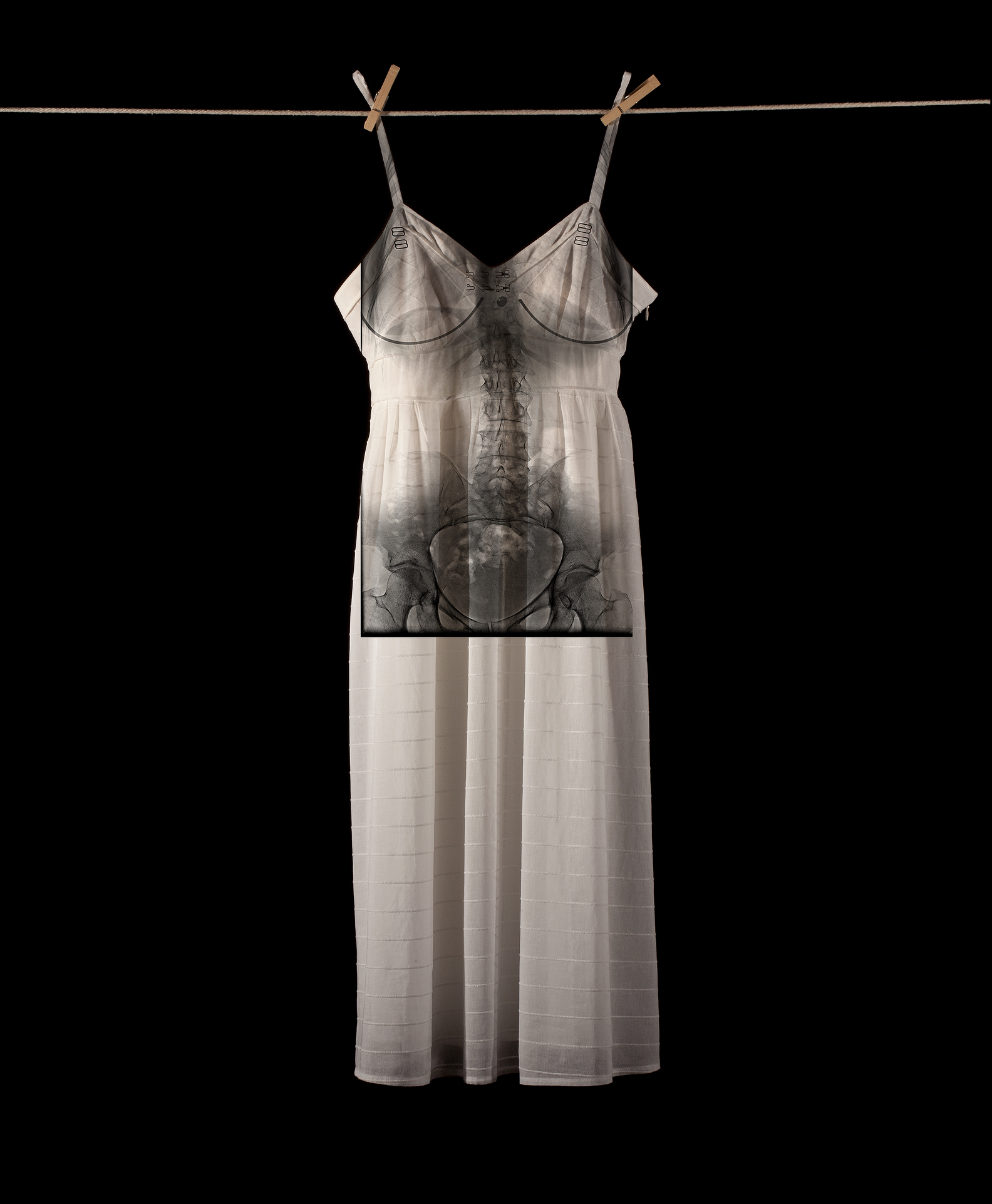   Exposed  15 x 20 x 5 in [38 x 50.8 x 13 cm] Archival pigment print on museum cotton rag, steel and plexiglass vintage x-ray box 