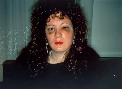 Nan Goldin, 'Nan one month after being battered' (1984) New York