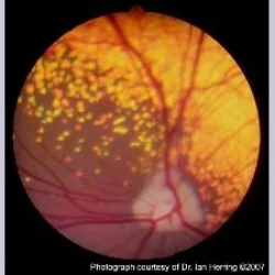 Normal Canine Retina