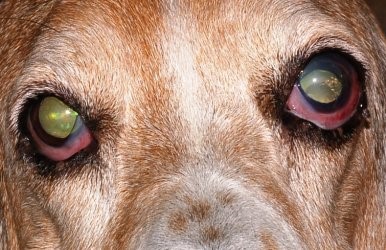 Chronic Glaucoma