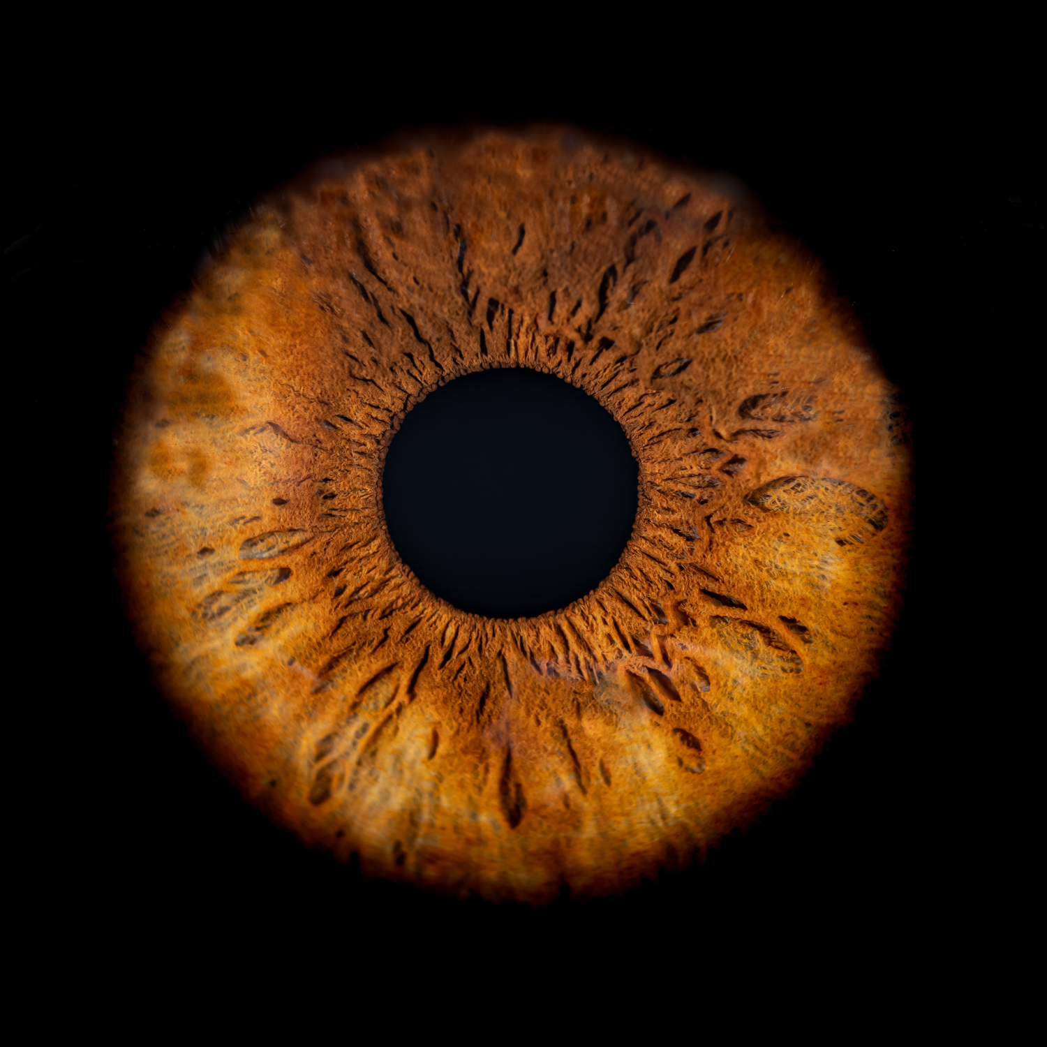 Close-up photograph of a true brown hematogenic iris, showing rich brown pigmentation, distinct radial fibers, and visible iris structures against a deep black background.