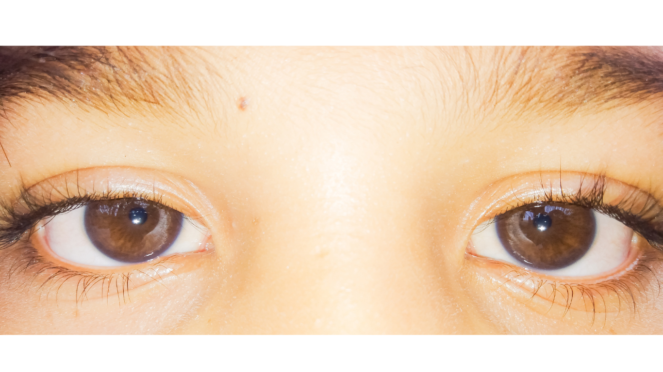 Brown and Biliary Eyes for IIPA.png