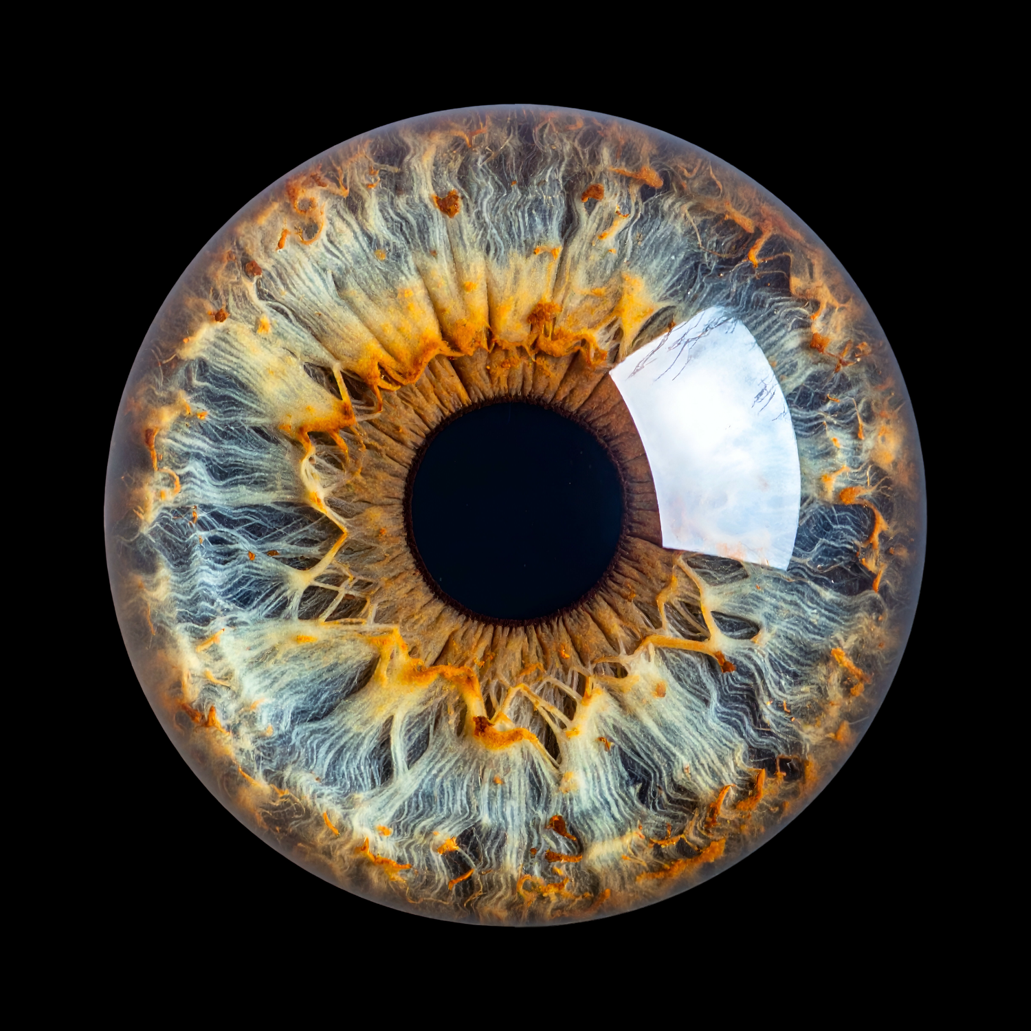 Image #1 Alt Text:  Close-up photograph of a blue iris with brown central heterochromia, intricate radial fibers, and distinct iris structures against a dark background.