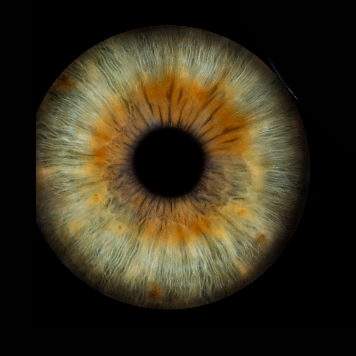 Close-up photograph of a blue iris with a lymphatic constitution and brown central heterochromia, showing distinct radial fibers and pigmentation surrounding the pupil against a black background.