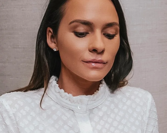 In my before picture, you will notice that the right side of my upper lip has less fullness to it. This was the concern I addressed with Christy with hopes of evening that out and plumping it up for an even, symmetrical look.