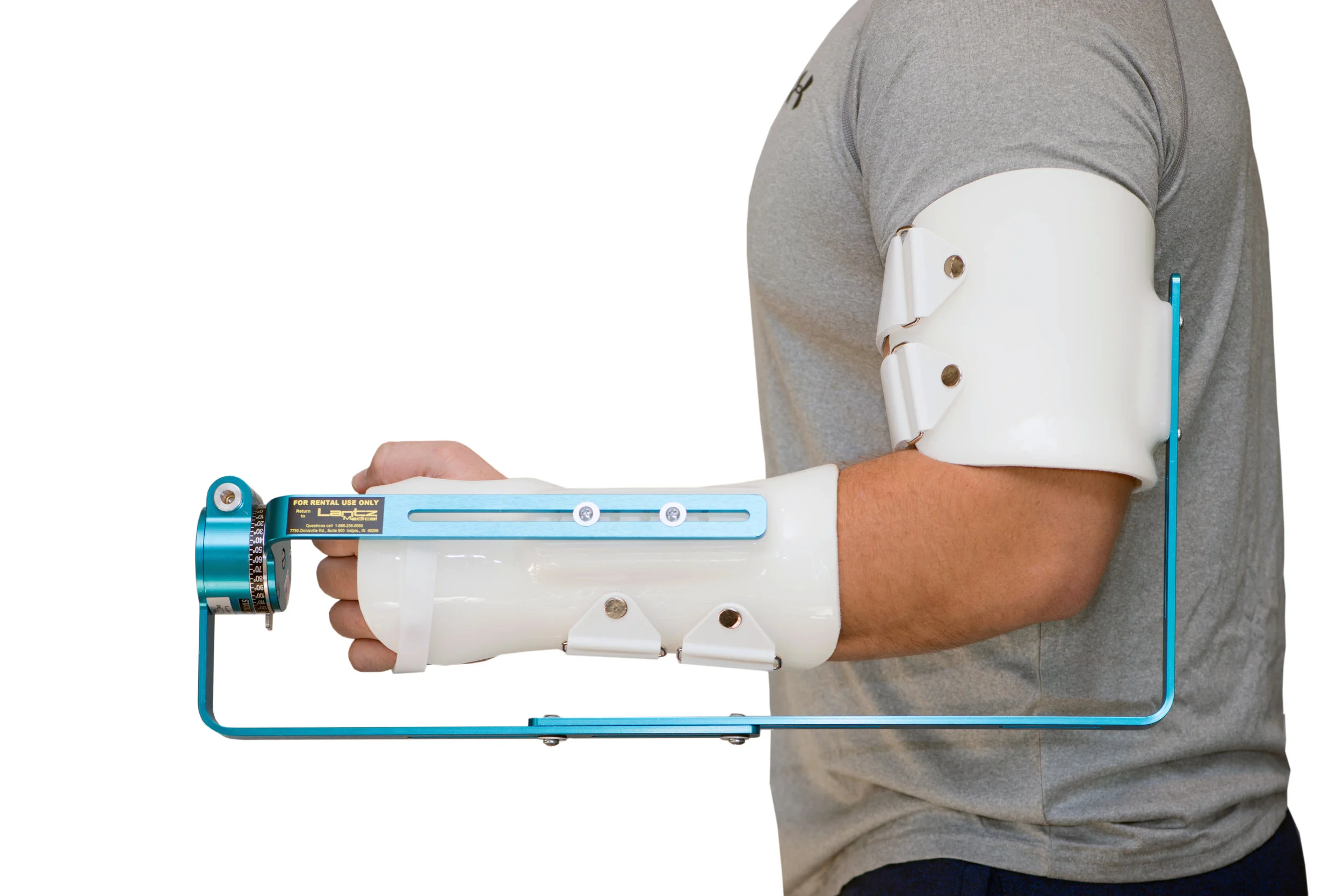 Splint Orearm Pronatedf