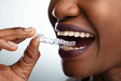 DIY Orthodontics.jpg