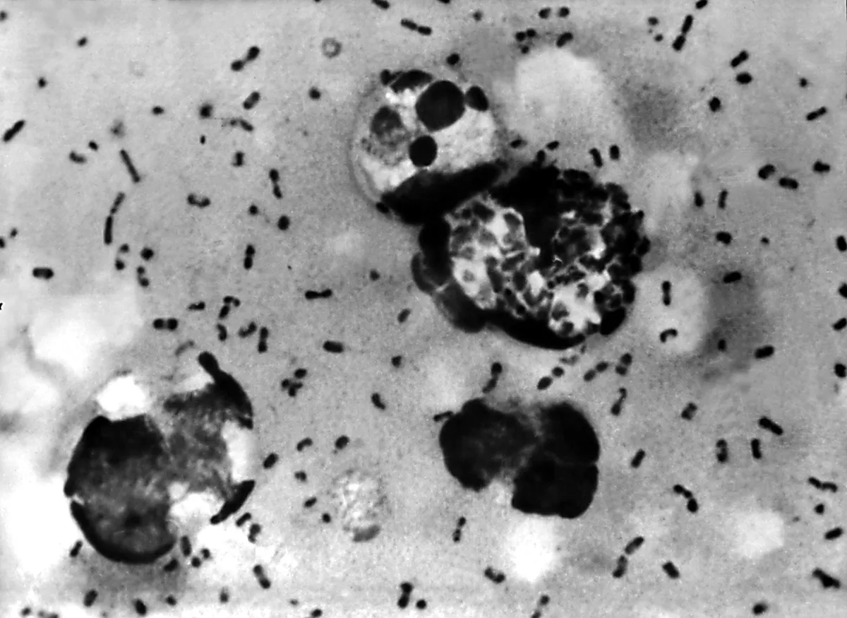 Pneumonia of Unknown Aetiology