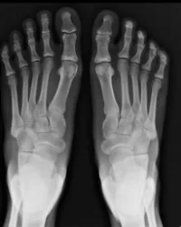 xray_01.jpg