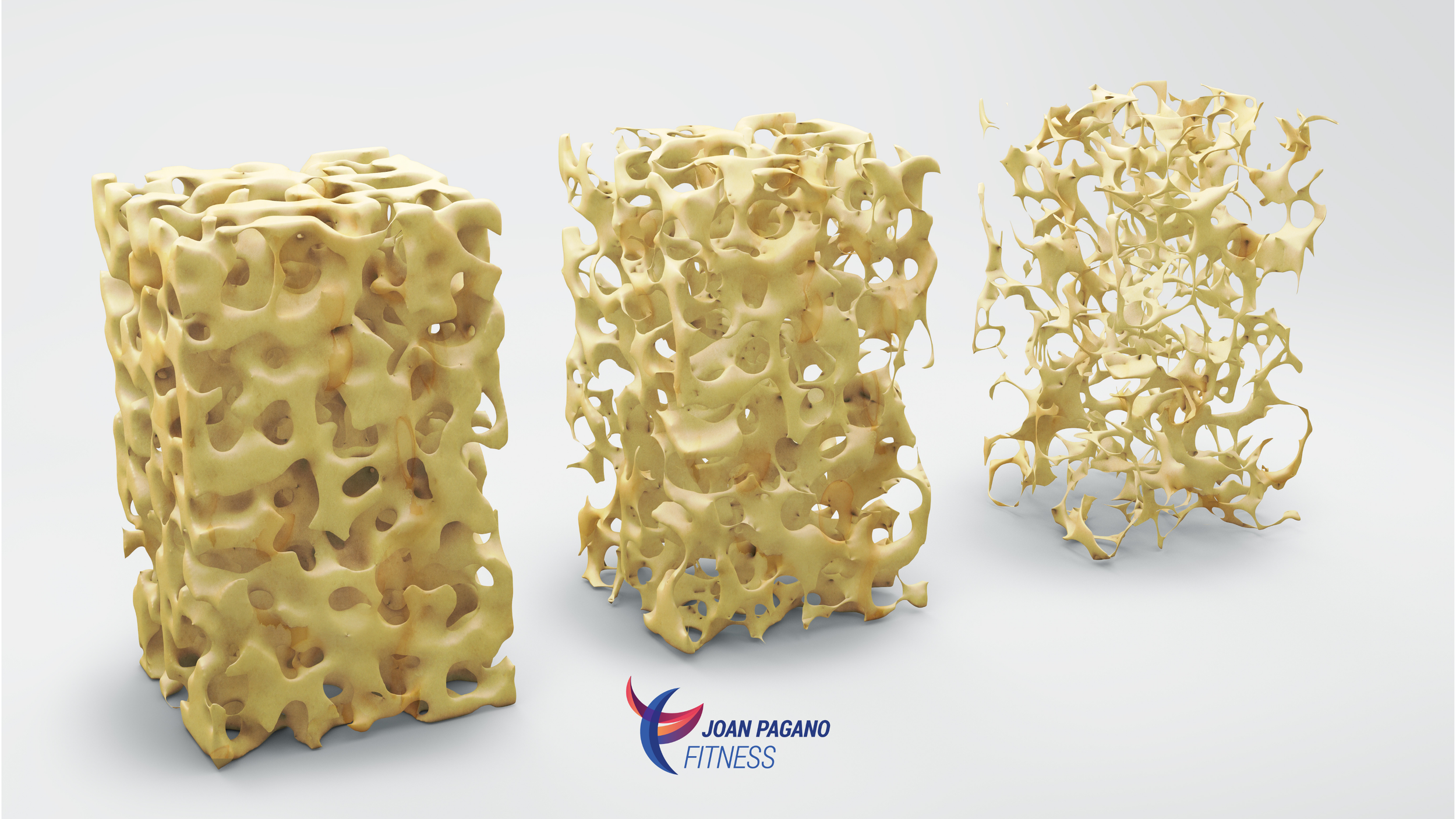 How Do You Stop Osteopenia from Progressing?